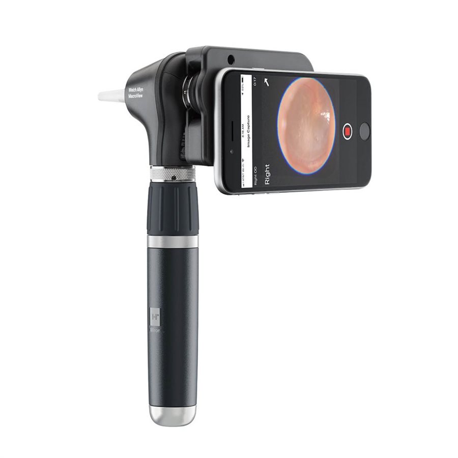Welch Allyn 3.5V LED MacroView Plus Otoscope Head for iExaminer