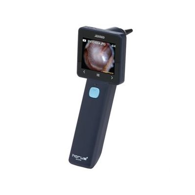 JedMed Horus+ Digital Video Otoscope JedMed Horus+ Digital Video Otoscope