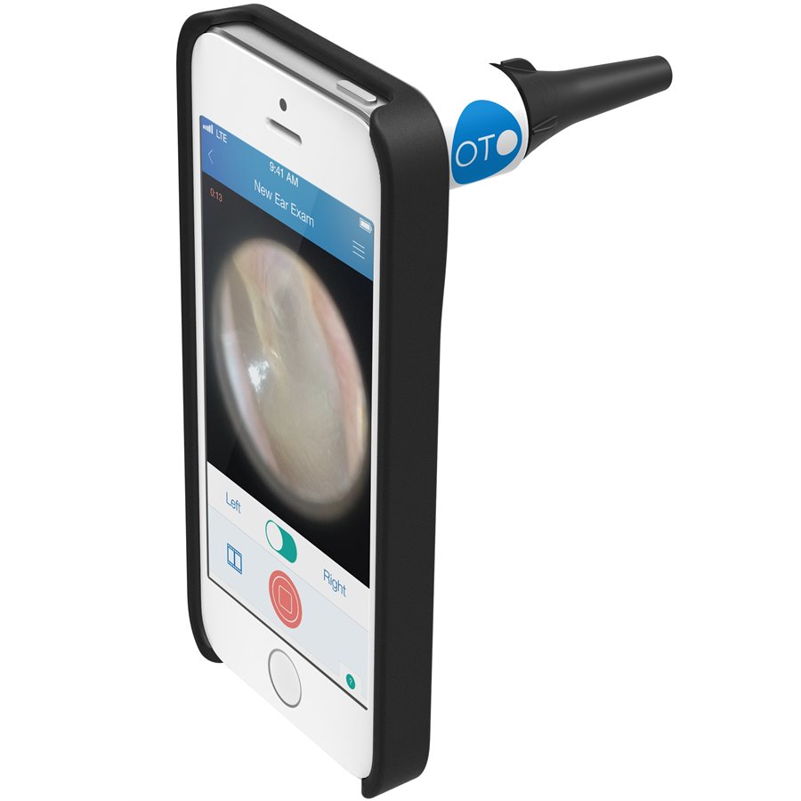 CellScope Oto Video Otoscope for iPhone 5, 5S, SE, 6, 6s, & 7